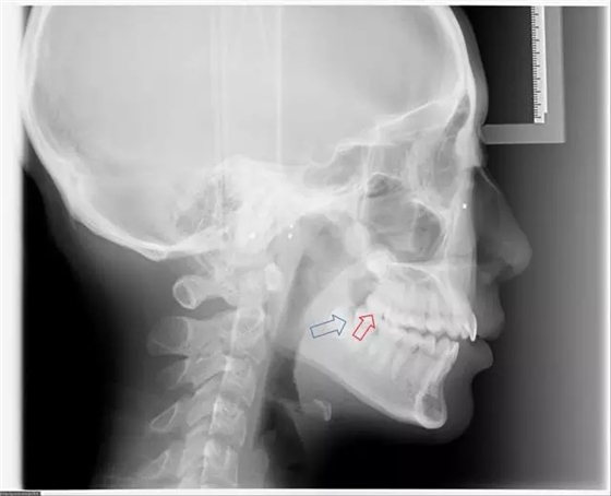 640.webp (1).jpg 640.webp (1).jpg