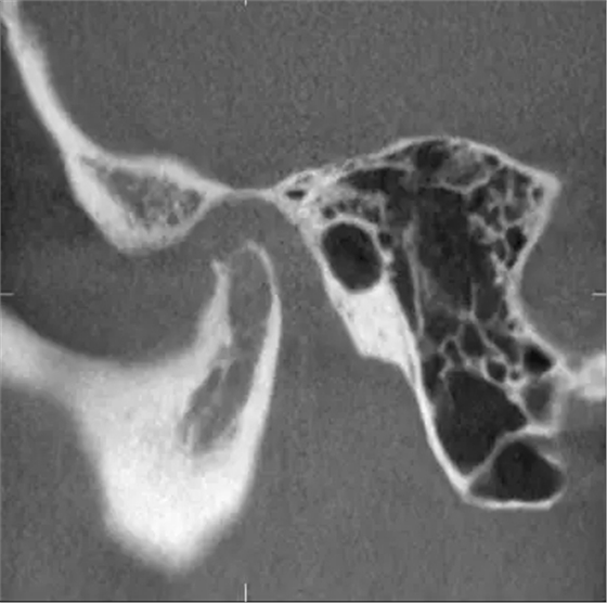 640.webp (2).jpg 640.webp (2).jpg