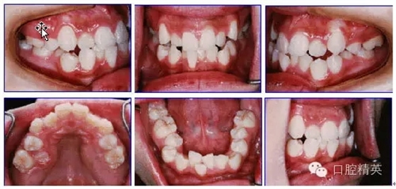 640.webp (1).jpg 640.webp (1).jpg