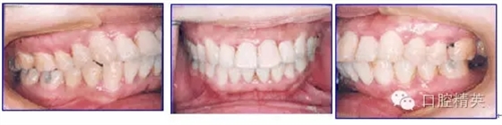 640.webp (3).jpg 640.webp (3).jpg