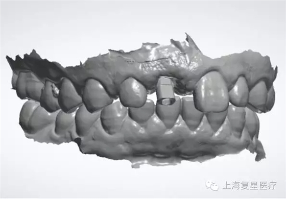 640.webp (4).jpg 640.webp (4).jpg