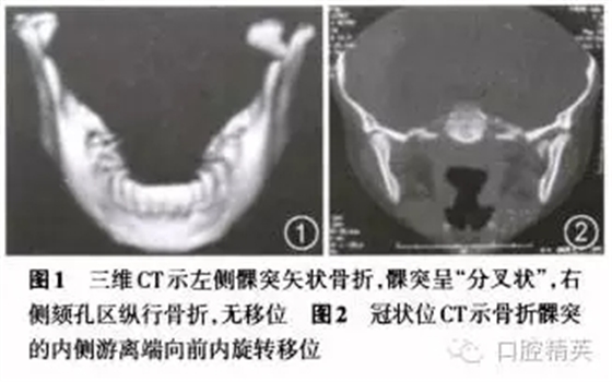 640.webp (14).jpg 640.webp (14).jpg