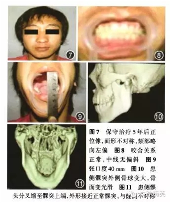 640.webp (16).jpg 640.webp (16).jpg