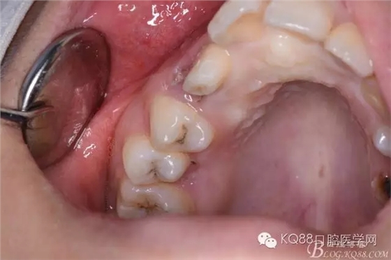 640.webp (2).jpg 640.webp (2).jpg