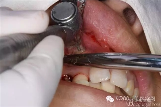 640.webp (8).jpg 640.webp (8).jpg