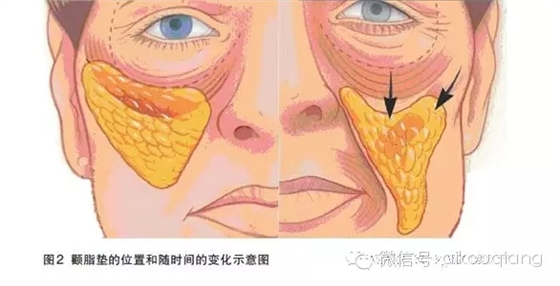 640.webp (11).jpg 640.webp (11).jpg