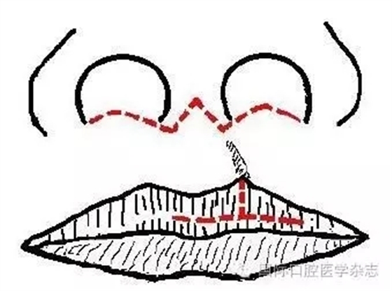 640.webp (2).jpg 640.webp (2).jpg