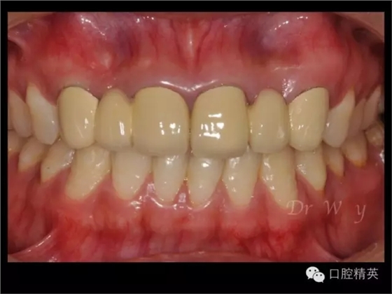 640.webp (3).jpg 640.webp (3).jpg