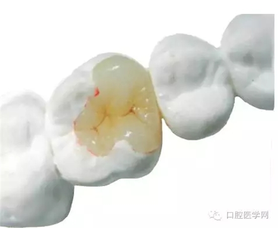 640.webp (3).jpg 640.webp (3).jpg