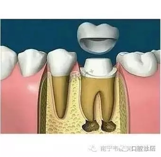 640.webp (1).jpg 640.webp (1).jpg