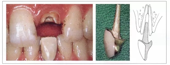 640.webp (5).jpg 640.webp (5).jpg