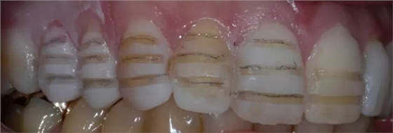 640.webp (5).jpg 640.webp (5).jpg