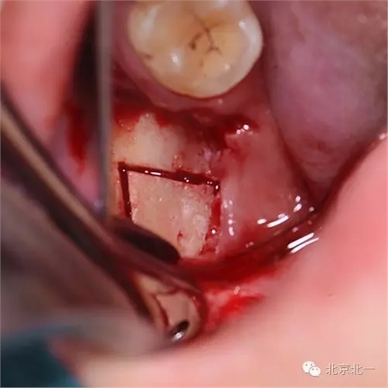 640.webp (3).jpg 640.webp (3).jpg