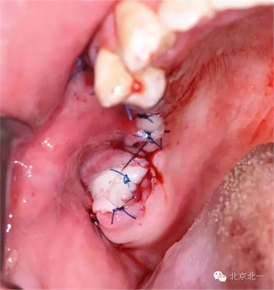 640.webp (9).jpg 640.webp (9).jpg