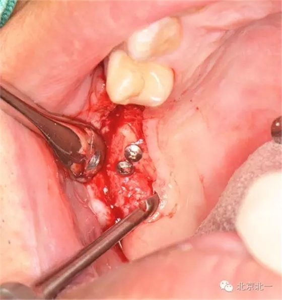 640.webp (11).jpg 640.webp (11).jpg