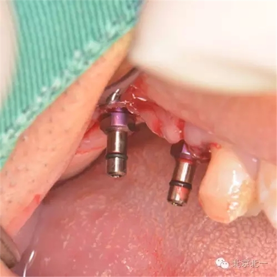 640.webp (15).jpg 640.webp (15).jpg