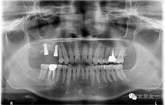 640.webp (22).jpg 640.webp (22).jpg