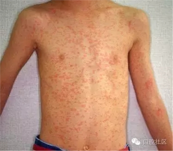 640.webp (11).jpg 640.webp (11).jpg