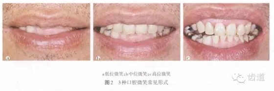 640.webp.jpg 640.webp.jpg