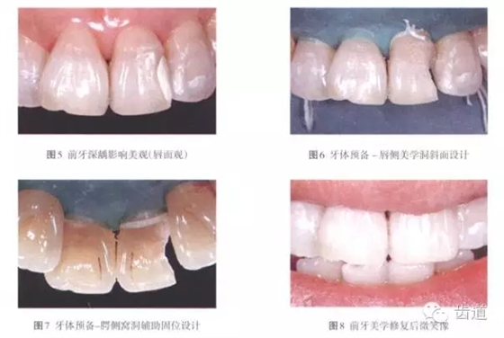 640.webp (3).jpg 640.webp (3).jpg