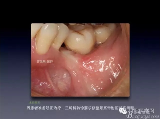 640.webp (1).jpg 640.webp (1).jpg