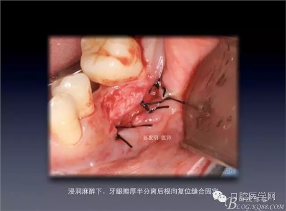 640.webp (2).jpg 640.webp (2).jpg