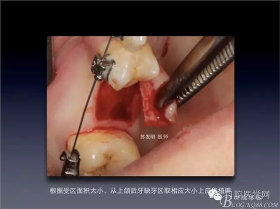 640.webp (3).jpg 640.webp (3).jpg