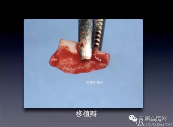 640.webp (4).jpg 640.webp (4).jpg