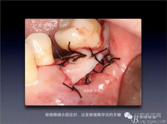 640.webp (5).jpg 640.webp (5).jpg