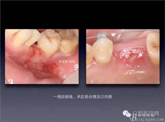 640.webp (7).jpg 640.webp (7).jpg