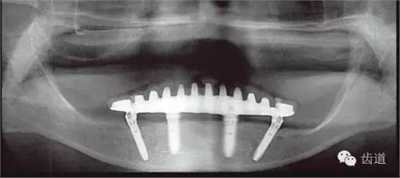 640.webp (3).jpg 640.webp (3).jpg