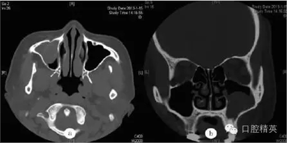 640.webp.jpg 640.webp.jpg