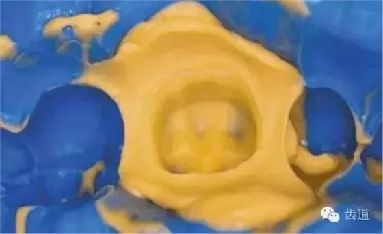 640.webp (3).jpg 640.webp (3).jpg