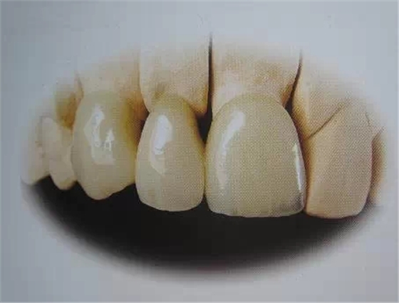 0.webp.jpg 0.webp.jpg