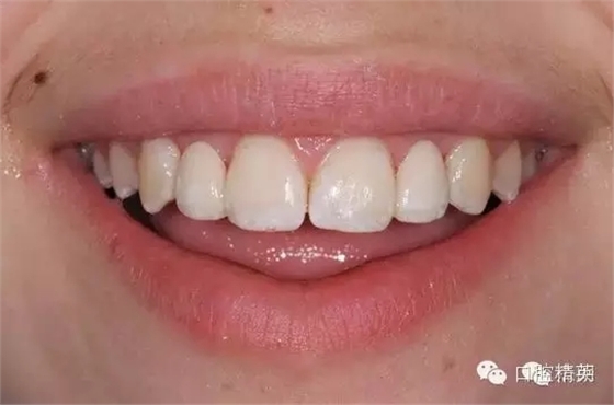 640.webp (13).jpg 640.webp (13).jpg