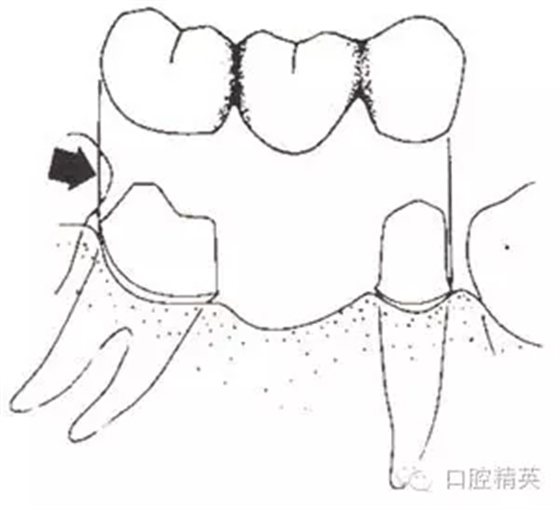 640.webp (4).jpg 640.webp (4).jpg