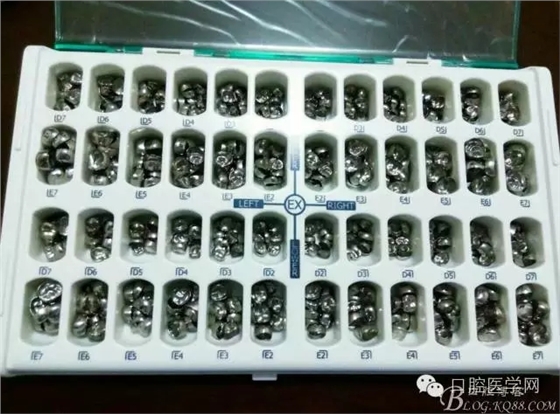 乳磨牙金屬預(yù)成冠制作 乳磨牙金屬預(yù)成冠制作