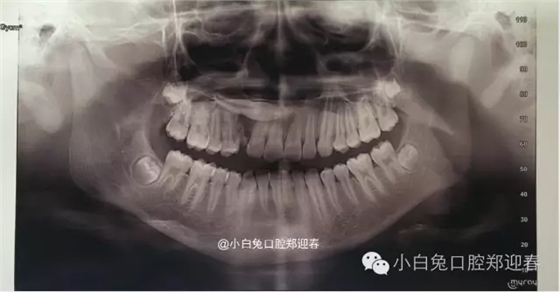 640.webp (1).jpg 640.webp (1).jpg