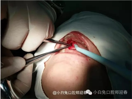 640.webp (5).jpg 640.webp (5).jpg