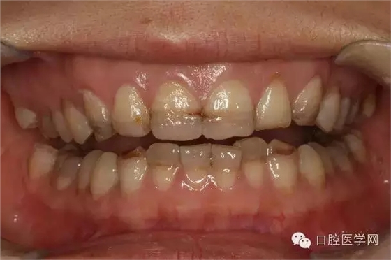 640.webp.jpg 640.webp.jpg