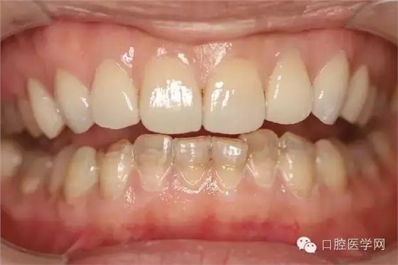 640.webp (2).jpg 640.webp (2).jpg