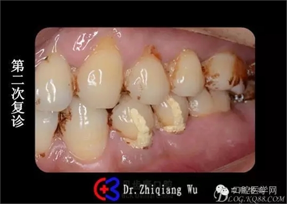 640.webp (3).jpg 640.webp (3).jpg