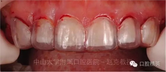 640.webp (2).jpg 640.webp (2).jpg