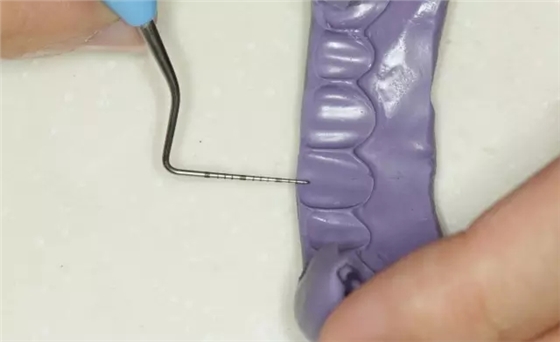 硅橡膠導(dǎo)板——牙體預(yù)備步驟詳解 硅橡膠導(dǎo)板——牙體預(yù)備步驟詳解