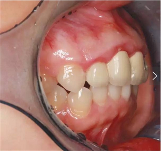 QQ圖片20161111165420.png QQ圖片20161111165420.png