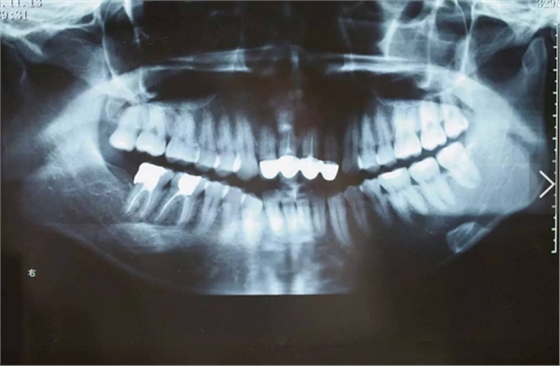 QQ圖片20161111165435.png QQ圖片20161111165435.png