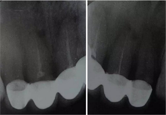 QQ圖片20161111165450.png QQ圖片20161111165450.png