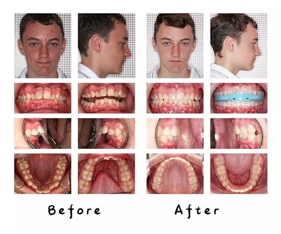 640.webp (3).jpg 640.webp (3).jpg