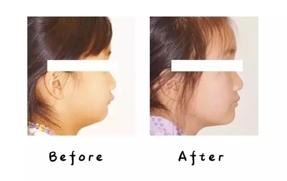 640.webp (4).jpg 640.webp (4).jpg