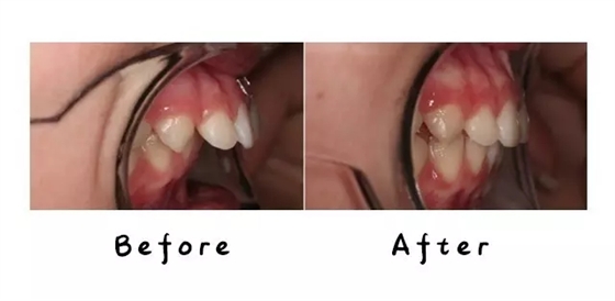 640.webp (5).jpg 640.webp (5).jpg